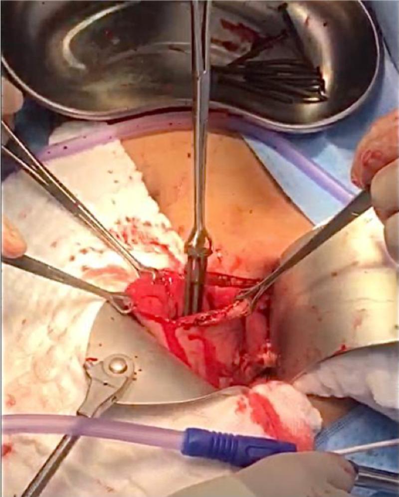 https://cdn.ncbi.nlm.nih.gov/pmc/blobs/9d82/7797438/0189c0c13563/cureus-0013-00000012597-i03.jpg