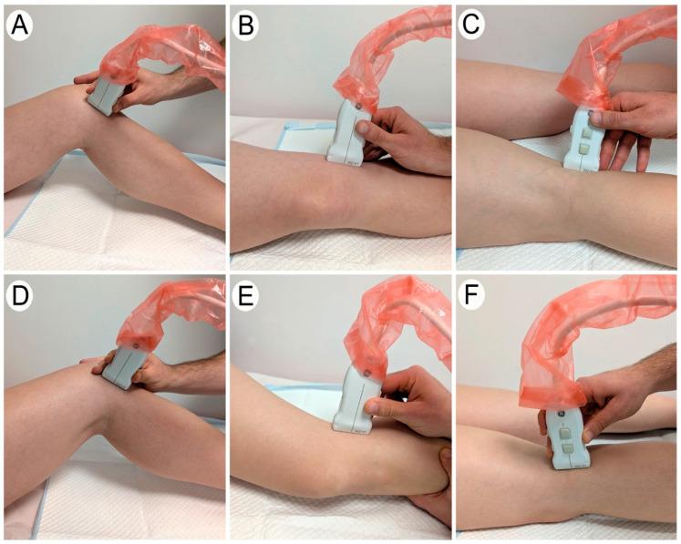 https://cdn.ncbi.nlm.nih.gov/pmc/blobs/9d84/11817143/935469418e39/diagnostics-15-00389-g001.jpg