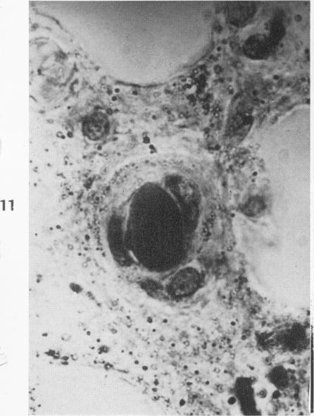 https://cdn.ncbi.nlm.nih.gov/pmc/blobs/9d86/1942678/755dc8a49478/amjpathol00697-0018-c.jpg
