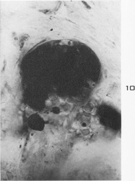 https://cdn.ncbi.nlm.nih.gov/pmc/blobs/9d86/1942678/f02748ea7d98/amjpathol00697-0018-b.jpg