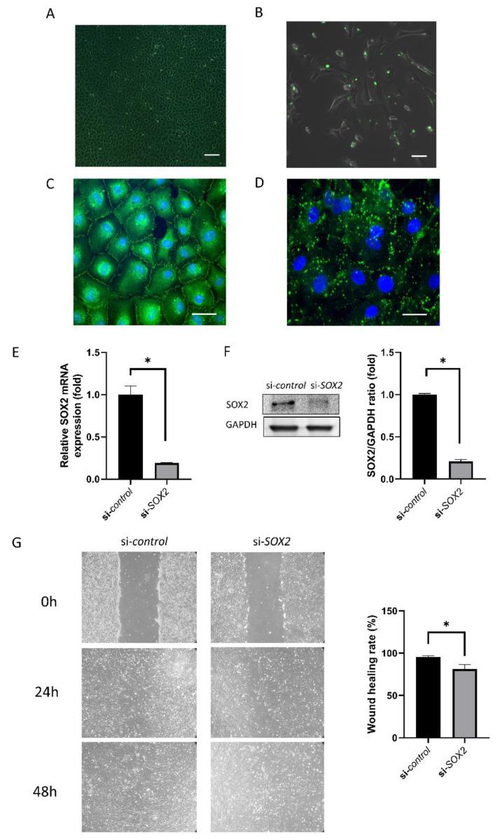 https://cdn.ncbi.nlm.nih.gov/pmc/blobs/9d8c/7352647/74736329d7dd/ijms-21-04397-g001.jpg