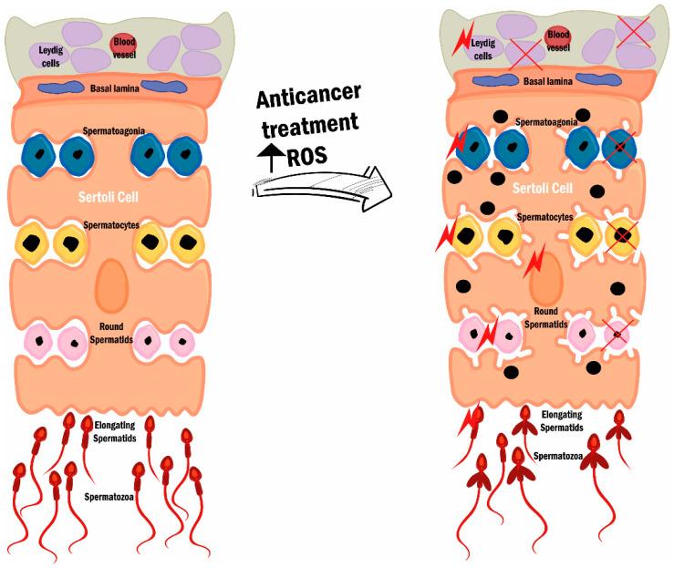 https://cdn.ncbi.nlm.nih.gov/pmc/blobs/9d8e/8946252/53b84d7d717c/cancers-14-01585-g004.jpg