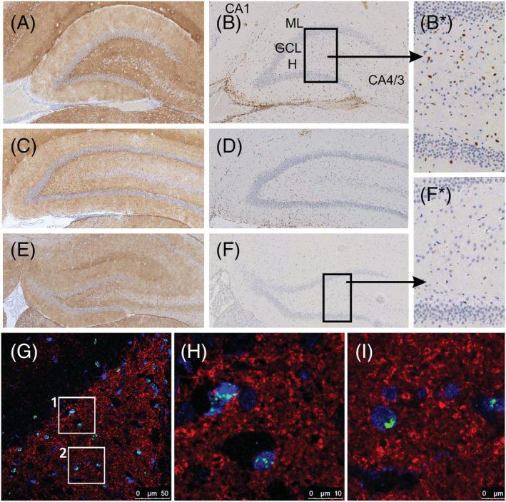 https://cdn.ncbi.nlm.nih.gov/pmc/blobs/9d8f/10947283/2290a85bef07/NAN-49-0-g004.jpg