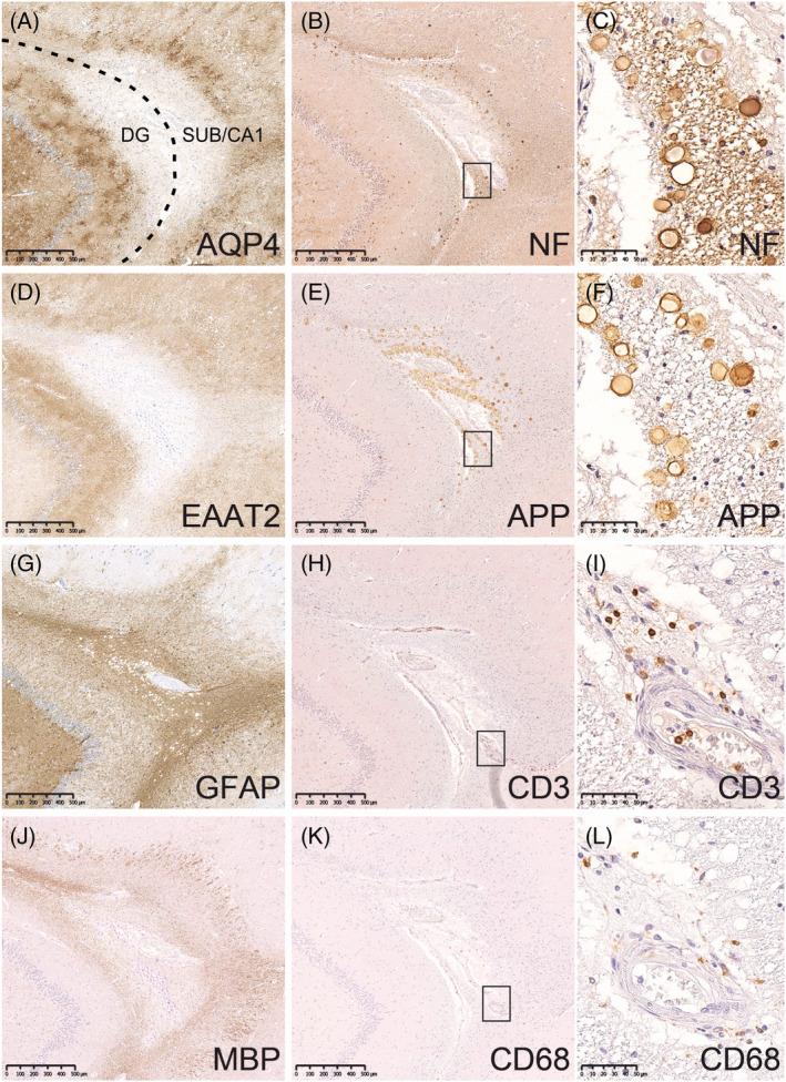 https://cdn.ncbi.nlm.nih.gov/pmc/blobs/9d8f/10947283/f82f105f8381/NAN-49-0-g006.jpg