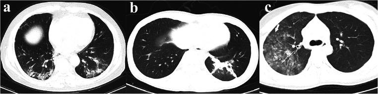 https://cdn.ncbi.nlm.nih.gov/pmc/blobs/9d91/7216854/af1e2b01096b/330_2020_6928_Fig3_HTML.jpg