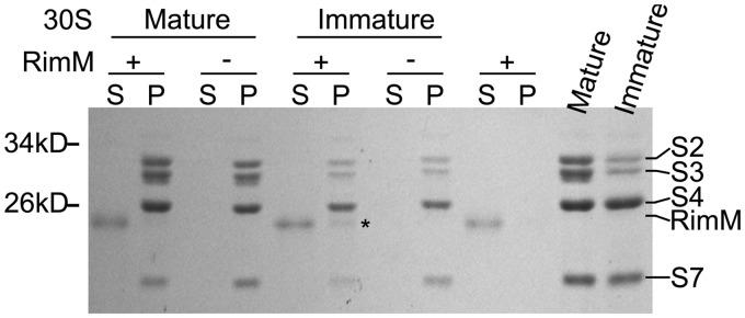 https://cdn.ncbi.nlm.nih.gov/pmc/blobs/9da1/3575805/3a4347cf0df2/gks1256f4p.jpg