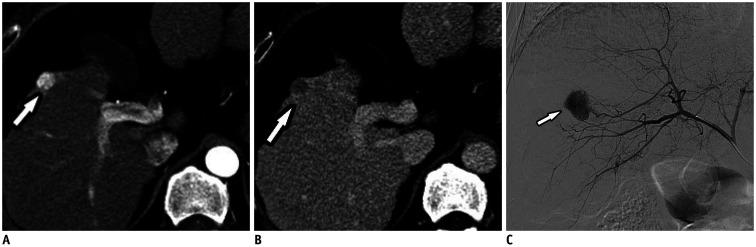 https://cdn.ncbi.nlm.nih.gov/pmc/blobs/9dac/7817628/54f31cc2af48/kjr-22-213-g001.jpg