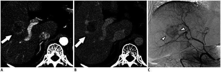 https://cdn.ncbi.nlm.nih.gov/pmc/blobs/9dac/7817628/af102eaa67b7/kjr-22-213-g002.jpg