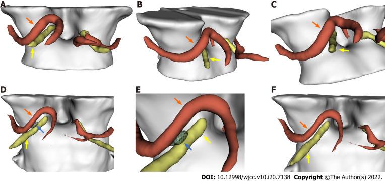 https://cdn.ncbi.nlm.nih.gov/pmc/blobs/9dc2/9297433/31feef3140cf/WJCC-10-7138-g002.jpg