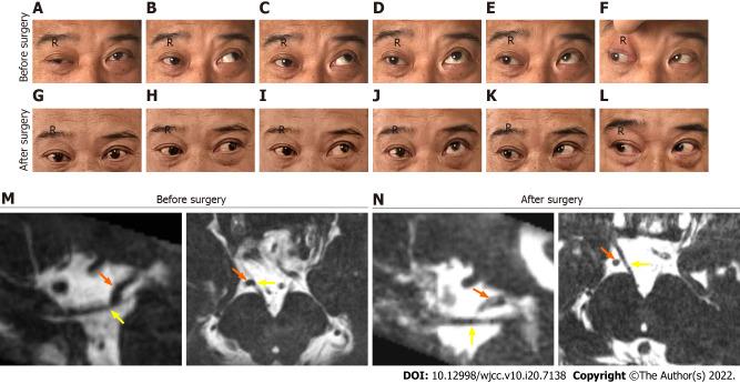 https://cdn.ncbi.nlm.nih.gov/pmc/blobs/9dc2/9297433/b05aa955de98/WJCC-10-7138-g001.jpg