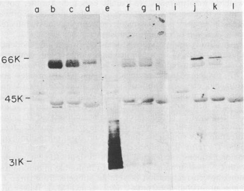 https://cdn.ncbi.nlm.nih.gov/pmc/blobs/9dc3/264282/05ca0042263e/iai00132-0221-d.jpg