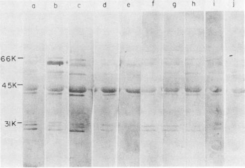 https://cdn.ncbi.nlm.nih.gov/pmc/blobs/9dc3/264282/07077ace8dc5/iai00132-0219-d.jpg