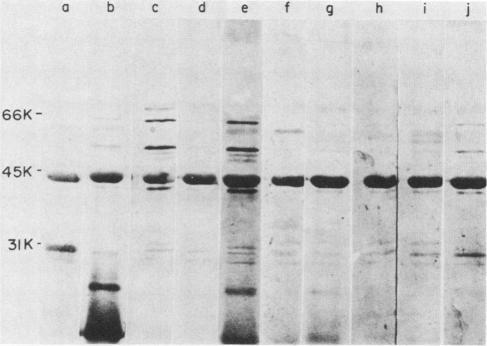 https://cdn.ncbi.nlm.nih.gov/pmc/blobs/9dc3/264282/461a69800d51/iai00132-0219-b.jpg