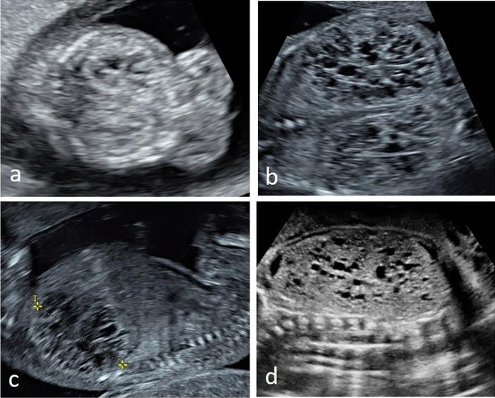 https://cdn.ncbi.nlm.nih.gov/pmc/blobs/9dc3/9300526/3c083a0e7a4a/404_2021_6265_Fig1_HTML.jpg