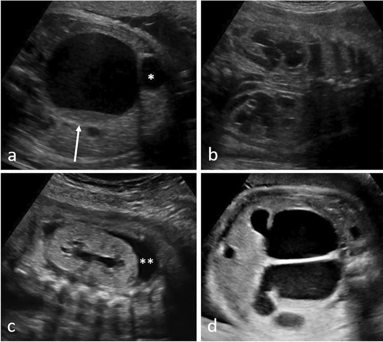 https://cdn.ncbi.nlm.nih.gov/pmc/blobs/9dc3/9300526/e42cd3fcb08e/404_2021_6265_Fig3_HTML.jpg