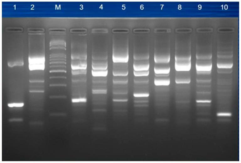 https://cdn.ncbi.nlm.nih.gov/pmc/blobs/9dc5/6352282/65dcd8cd6220/jcm-08-00008-g003.jpg
