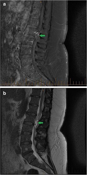 https://cdn.ncbi.nlm.nih.gov/pmc/blobs/9dca/4834819/796d9806f79c/12998_2016_94_Fig1_HTML.jpg