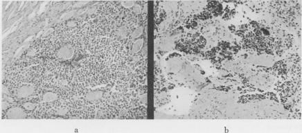 https://cdn.ncbi.nlm.nih.gov/pmc/blobs/9dcd/1450870/2ff320575735/annsurg01228-0130-a.jpg