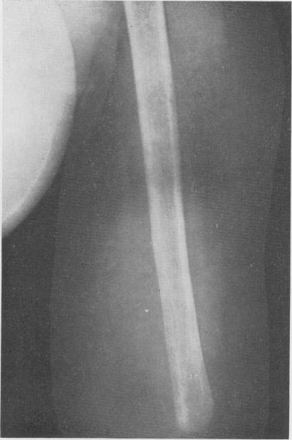 https://cdn.ncbi.nlm.nih.gov/pmc/blobs/9dcd/1450870/545215e0008a/annsurg01228-0131-a.jpg
