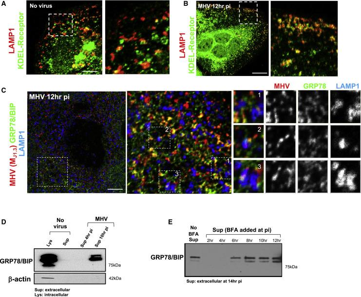 https://cdn.ncbi.nlm.nih.gov/pmc/blobs/9dce/7590812/5a30484c31c3/gr3_lrg.jpg
