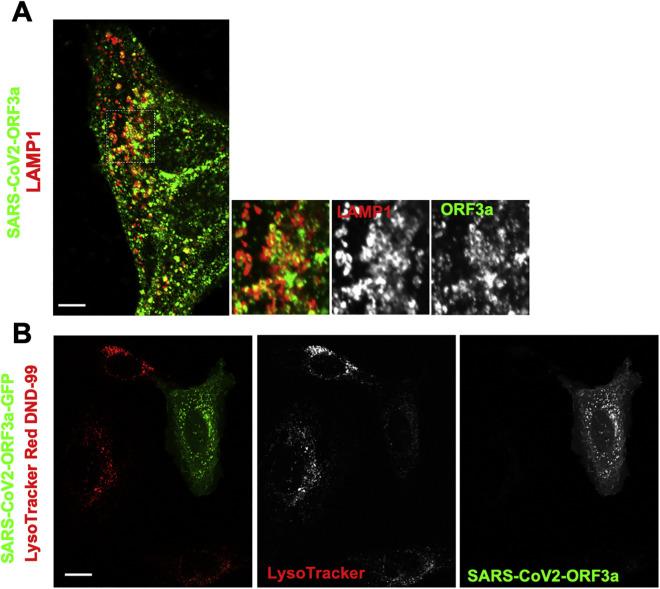 https://cdn.ncbi.nlm.nih.gov/pmc/blobs/9dce/7590812/c58c9ac5f1f9/figs5_lrg.jpg