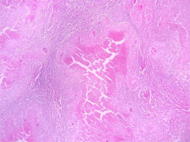 https://cdn.ncbi.nlm.nih.gov/pmc/blobs/9dd0/12144955/18a94fe27eda/gr3.jpg