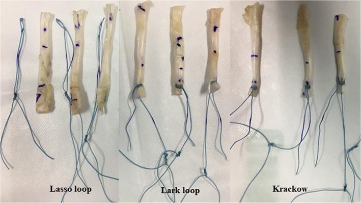 https://cdn.ncbi.nlm.nih.gov/pmc/blobs/9dd2/10102316/dbe32065d623/OS-15-1136-g005.jpg