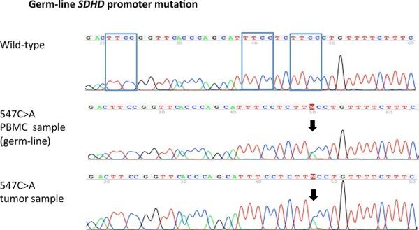 https://cdn.ncbi.nlm.nih.gov/pmc/blobs/9dd3/4694872/991a0d0bb85c/oncotarget-06-25868-g003.jpg