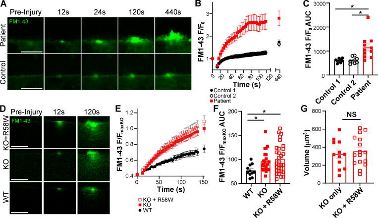 https://cdn.ncbi.nlm.nih.gov/pmc/blobs/9dd4/7844426/c159c7dd8ba6/JCB_202007059_Fig7.jpg