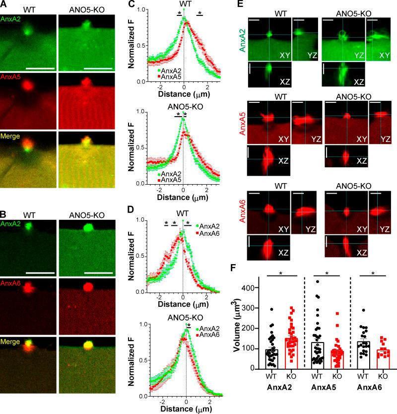 https://cdn.ncbi.nlm.nih.gov/pmc/blobs/9dd4/7844426/c250909b118e/JCB_202007059_Fig4.jpg