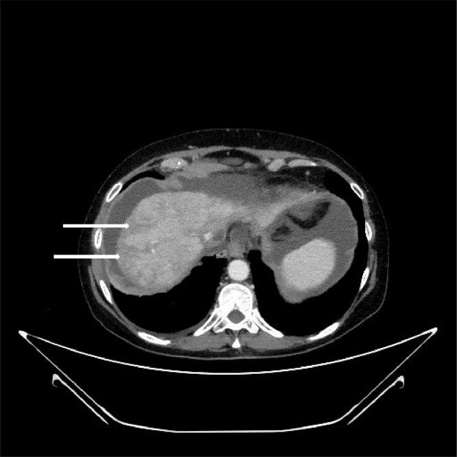 https://cdn.ncbi.nlm.nih.gov/pmc/blobs/9de4/10159811/6964f7bde197/gr1.jpg
