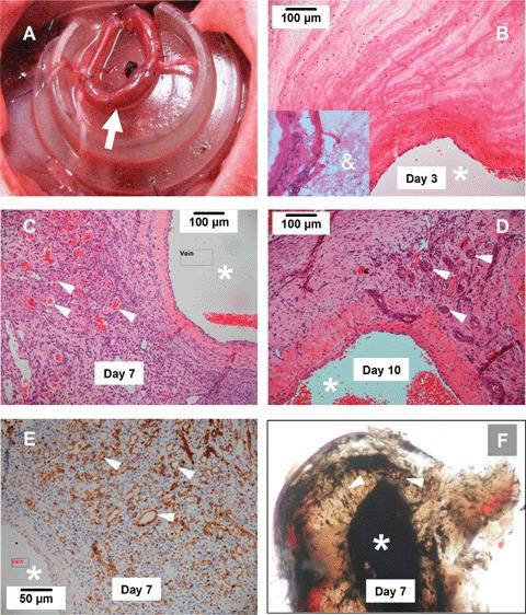 https://cdn.ncbi.nlm.nih.gov/pmc/blobs/9de5/4506171/7d2dcb710c0a/jcmm0012-2062-f1.jpg