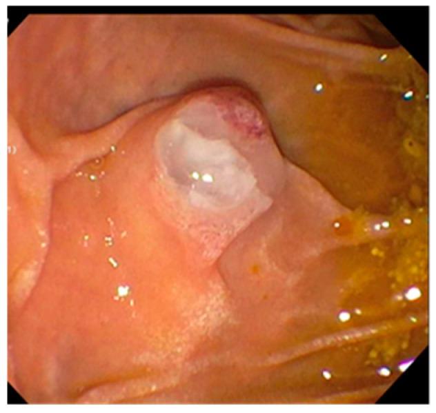 https://cdn.ncbi.nlm.nih.gov/pmc/blobs/9dea/7151166/276a0c99c39e/diagnostics-10-00132-g003.jpg