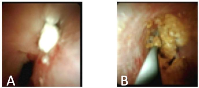 https://cdn.ncbi.nlm.nih.gov/pmc/blobs/9dea/7151166/3a3db8350013/diagnostics-10-00132-g004.jpg