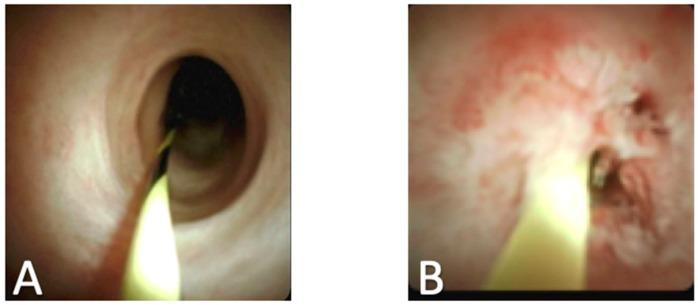 https://cdn.ncbi.nlm.nih.gov/pmc/blobs/9dea/7151166/a52cf3e4ee6d/diagnostics-10-00132-g005.jpg