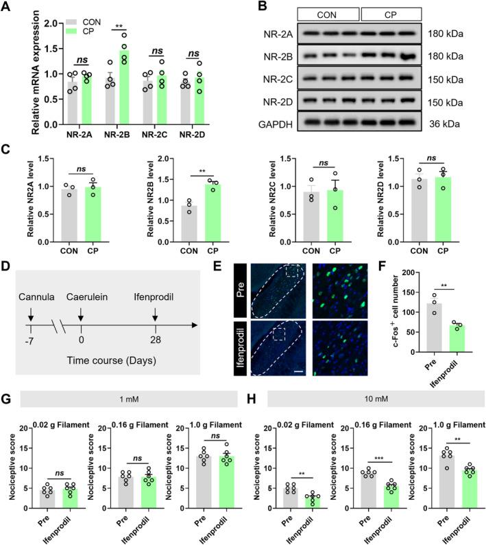 https://cdn.ncbi.nlm.nih.gov/pmc/blobs/9dec/11871393/fb74e076424b/CNS-31-e70313-g007.jpg