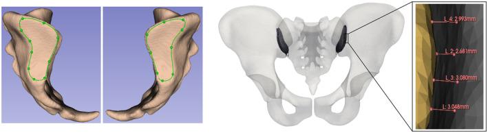 https://cdn.ncbi.nlm.nih.gov/pmc/blobs/9ded/11737311/f742cf5d22ae/JOA-246-258-g005.jpg