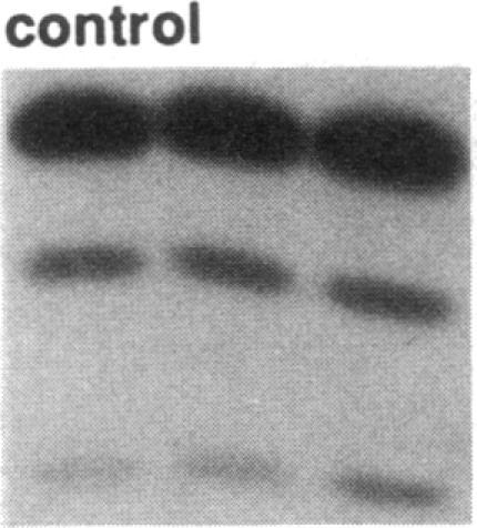 https://cdn.ncbi.nlm.nih.gov/pmc/blobs/9def/443283/af76907f7163/jcinvest00053-0512-a.jpg