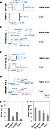 https://cdn.ncbi.nlm.nih.gov/pmc/blobs/9df4/7990328/fe652b8056b4/abc9992-F4.jpg