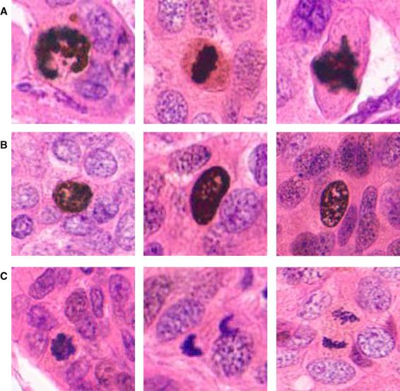 https://cdn.ncbi.nlm.nih.gov/pmc/blobs/9dfe/10100421/e28dfac531b6/HIS-82-393-g003.jpg