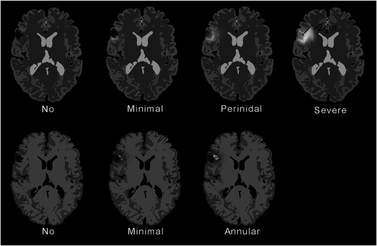 https://cdn.ncbi.nlm.nih.gov/pmc/blobs/9e01/8649916/164e5b91a8c0/10.1177_20584601211050886-fig1.jpg
