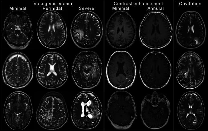 https://cdn.ncbi.nlm.nih.gov/pmc/blobs/9e01/8649916/beb6727258c3/10.1177_20584601211050886-fig3.jpg