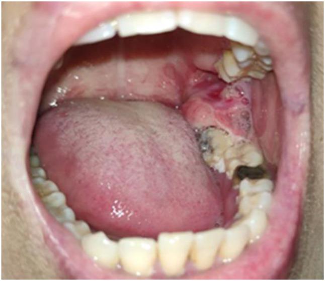 https://cdn.ncbi.nlm.nih.gov/pmc/blobs/9e07/12008927/8f9c42e1cd52/12903_2025_5995_Fig1_HTML.jpg