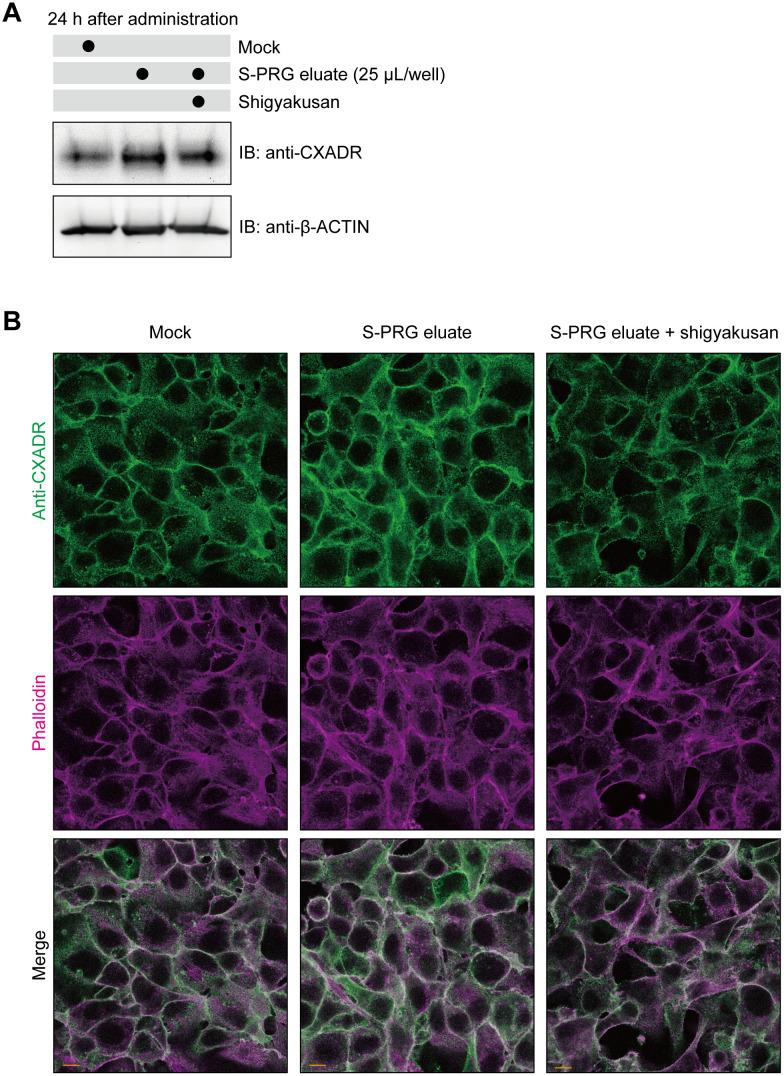 https://cdn.ncbi.nlm.nih.gov/pmc/blobs/9e07/9328573/6a3176fdb36b/pone.0271192.g004.jpg