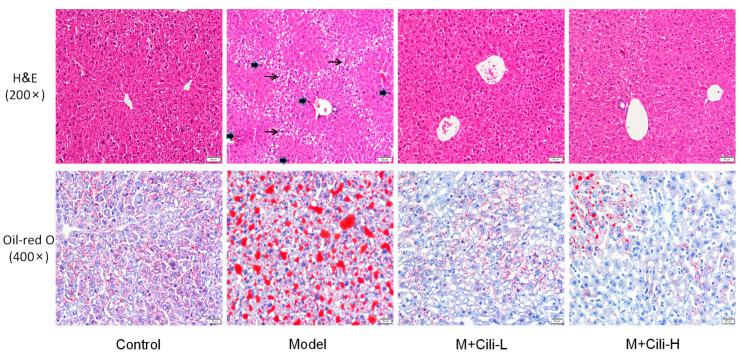 https://cdn.ncbi.nlm.nih.gov/pmc/blobs/9e0e/9104053/54f6b8e722c4/nutrients-14-01974-g004.jpg