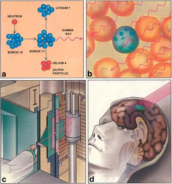 https://cdn.ncbi.nlm.nih.gov/pmc/blobs/9e10/6006699/defac3940739/40880_2018_280_Fig1_HTML.jpg