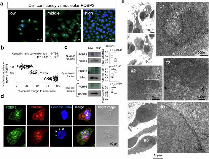 https://cdn.ncbi.nlm.nih.gov/pmc/blobs/9e18/11405525/9b3e65040c6d/44318_2024_192_Fig2_HTML.jpg
