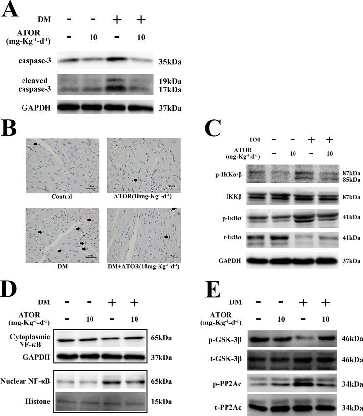 https://cdn.ncbi.nlm.nih.gov/pmc/blobs/9e18/5112957/7bd17593239a/pone.0166740.g006.jpg