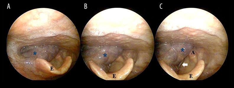 https://cdn.ncbi.nlm.nih.gov/pmc/blobs/9e18/8006475/3b409f2c2f53/amjcaserep-22-e931042-g001.jpg