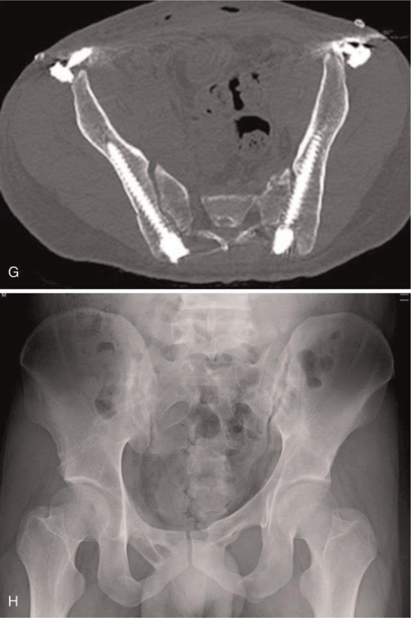 https://cdn.ncbi.nlm.nih.gov/pmc/blobs/9e1c/6587620/a18731bca6a1/medi-98-e16004-g004.jpg